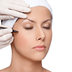 Eyelid Surgery (Blepharoplasty)