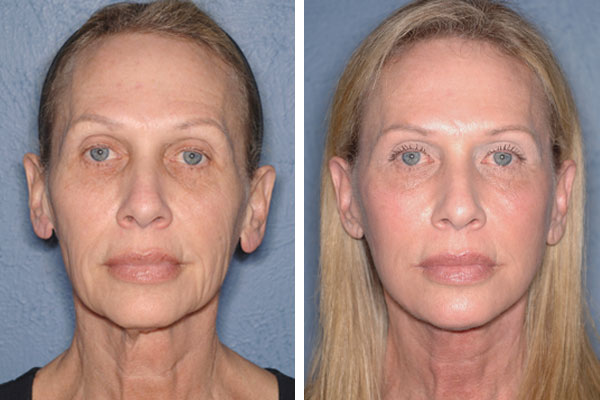 Best Plastic Surgeons in America, United States USA Best Plastic Surgeons in America One of The Worlds Best Plastic Surgeon plastic surgery before and after