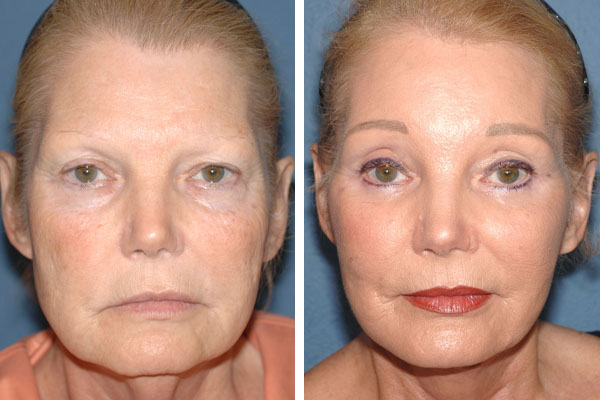 Best Plastic Surgeons in America, United States USA Best Plastic Surgeons in America One of The Worlds Best Plastic Surgeon plastic surgery before and after