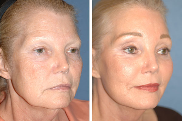 Best Plastic Surgeons in America, United States USA Best Plastic Surgeons in America One of The Worlds Best Plastic Surgeon plastic surgery before and after