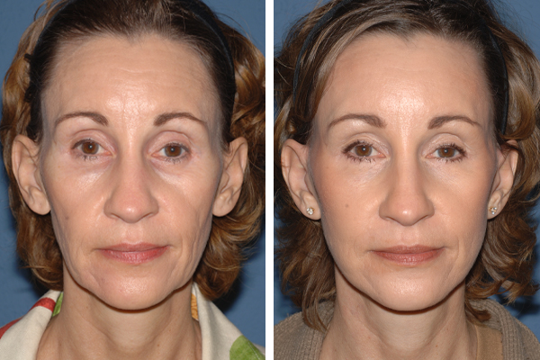 Best Plastic Surgeons in America, United States USA Best Plastic Surgeons in America One of The Worlds Best Plastic Surgeon plastic surgery before and after