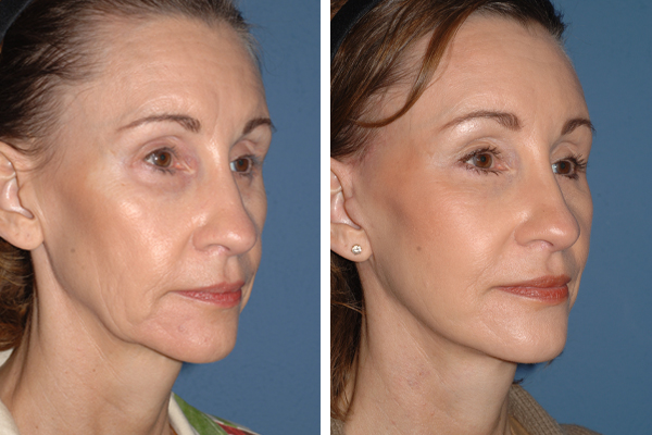 Best Plastic Surgeons in America, United States USA Best Plastic Surgeons in America One of The Worlds Best Plastic Surgeon plastic surgery before and after