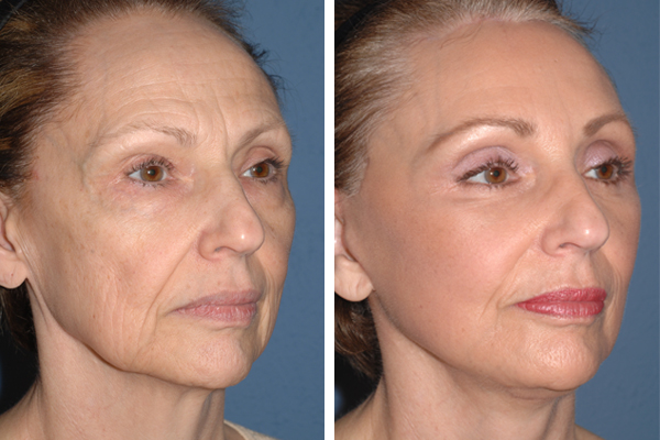 Best Plastic Surgeons in America, United States USA Best Plastic Surgeons in America One of The Worlds Best Plastic Surgeon plastic surgery before and after